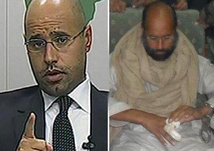 صورة سيف الإسلام بعد بتر اصابعه